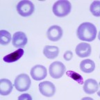 Южноафриканские ученые утверждают, что нашли лекарство против всех штаммов малярии